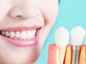 Dentist in Bellandur