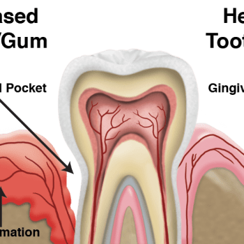 Best Dentist in Bellandur