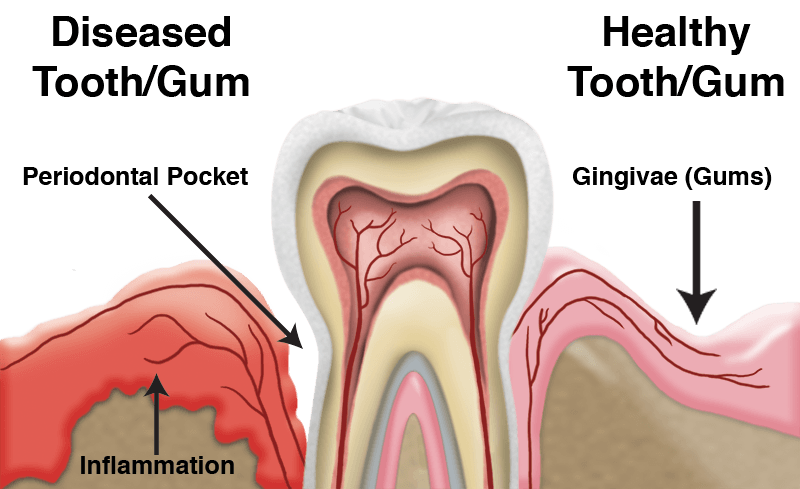 Best Dentist in Bellandur