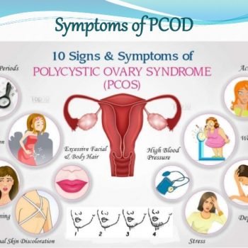 Diet counseling for PCODPCOS