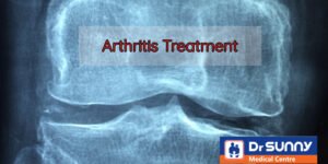 Orthopedic surgeon for arthritis treatment