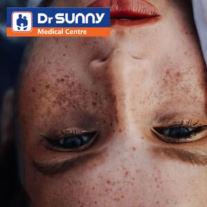 Skin Pigmentation in Dermatology