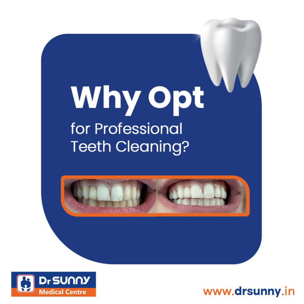 Why Opt for Professional Teeth Cleaning best dentist near me