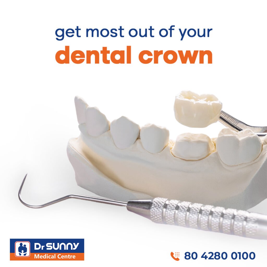 How to get most out of your dental crown